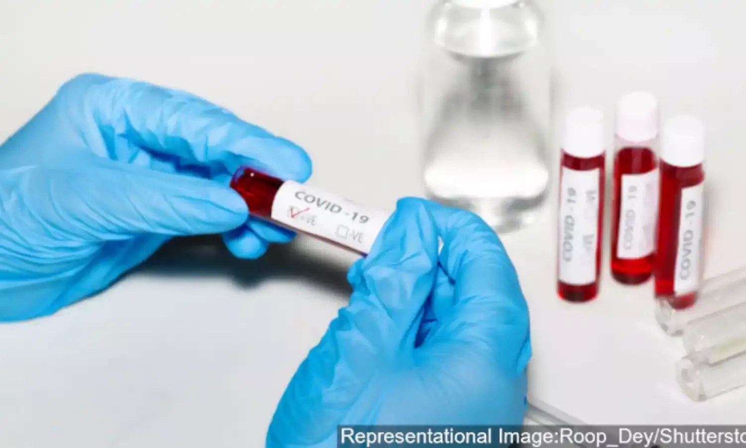 Study On COVID-19 Testing Data Calls For Random Testing, Improved Data Quality