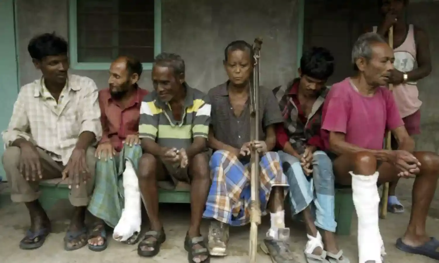 Unless India Delivers, World Won’t Be Leprosy Free