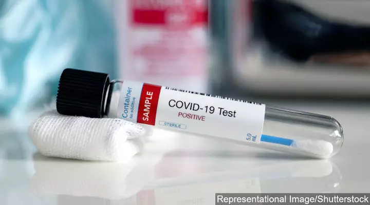 Explainer: What Happens During A COVID-19 Test
