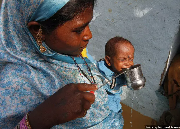 Why Bihar Can Treat Only 0.3% Of Malnourished Children