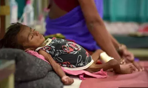 States With Highest Stunting Rates Are India’s Poorest (But Not Always) States With Highest Stunting Rates Are India’s Poorest (But Not Always)