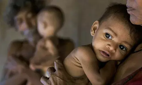 Only 1 In 10 Indian Children Aged 6-23 Months Gets Adequate Diet