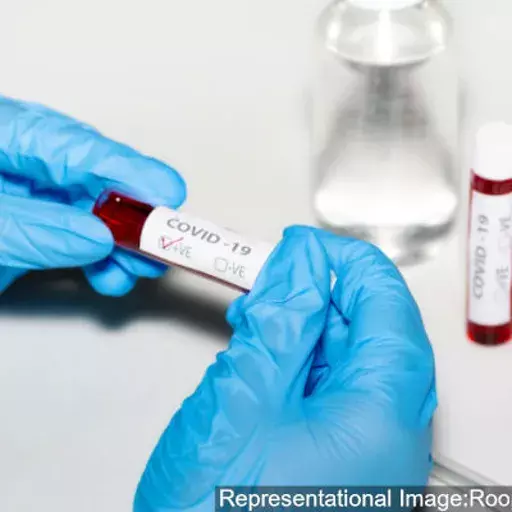 Study On COVID-19 Testing Data Calls For Random Testing, Improved Data Quality Study On COVID-19 Testing Data Calls For Random Testing, Improved Data Quality