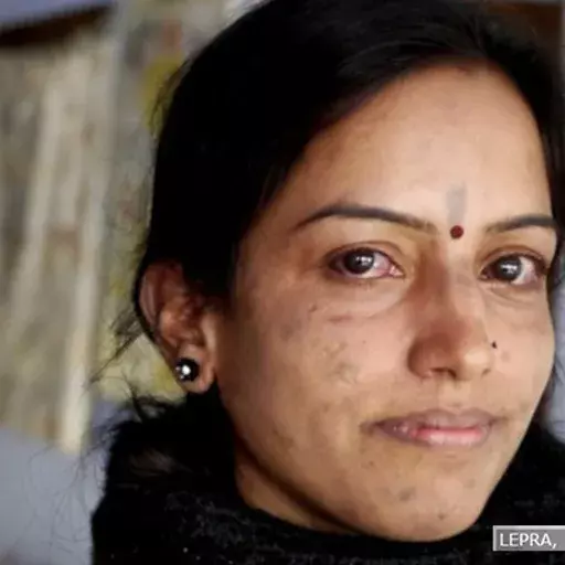 Do More Detected Cases Mean Leprosy Is Making A Comeback In India? Experts, Government Differ