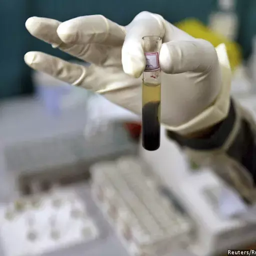 14,474 Cases Of HIV Through Blood Transfusion, But Govt Denies Crisis 14,474 Cases Of HIV Through Blood Transfusion, But Govt Denies Crisis