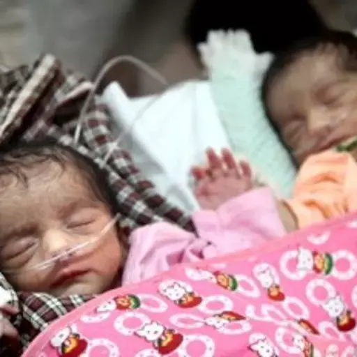 Bengal Is Attacked For Infant Deaths, But Statistics Tell A Different Story Bengal Is Attacked For Infant Deaths, But Statistics Tell A Different Story