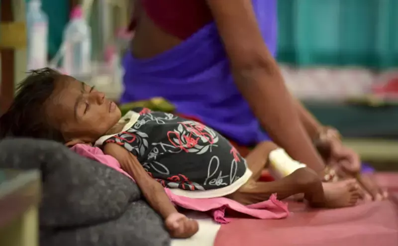 Why Malnutrition Remains A Challenge For India Why Malnutrition Remains A Challenge For India